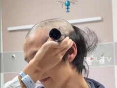 网红郭聪明剃光头发准备手术 引起网友热议！