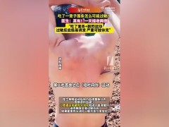 女子吃面后打羽毛球引发休克 医生:吃面条+剧烈运动,这种过敏十分特殊